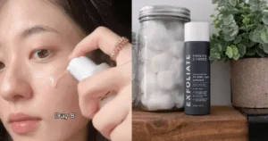 6-cach-duong-trang-da-don-gian-de-co-lan-da-sang-khoe-aknekit