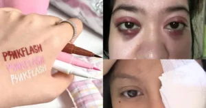 phan-mat-pinkflash-dinh-be-boi-va-cach-cham-soc-da-dau-mun-nhay-cam